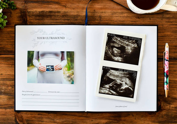 Dear Baby: A Pregnancy Prayer Journal & Memory Book for Moms | Ivory