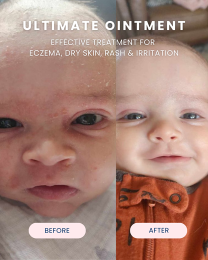 Ultimate Ointment